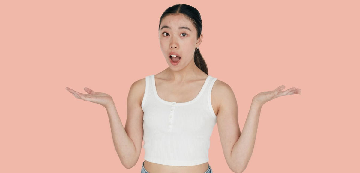 Blog cover: When Acne Attacks: The Emotional Rollercoaster You Didn't Sign Up For