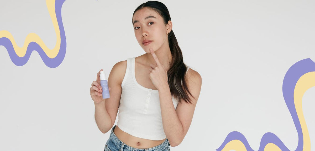 Blog cover: Scar Wars: How to Battle Acne Scars and Win