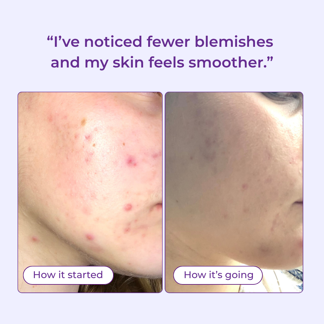 Face Up To It Clarifying Dry Oil