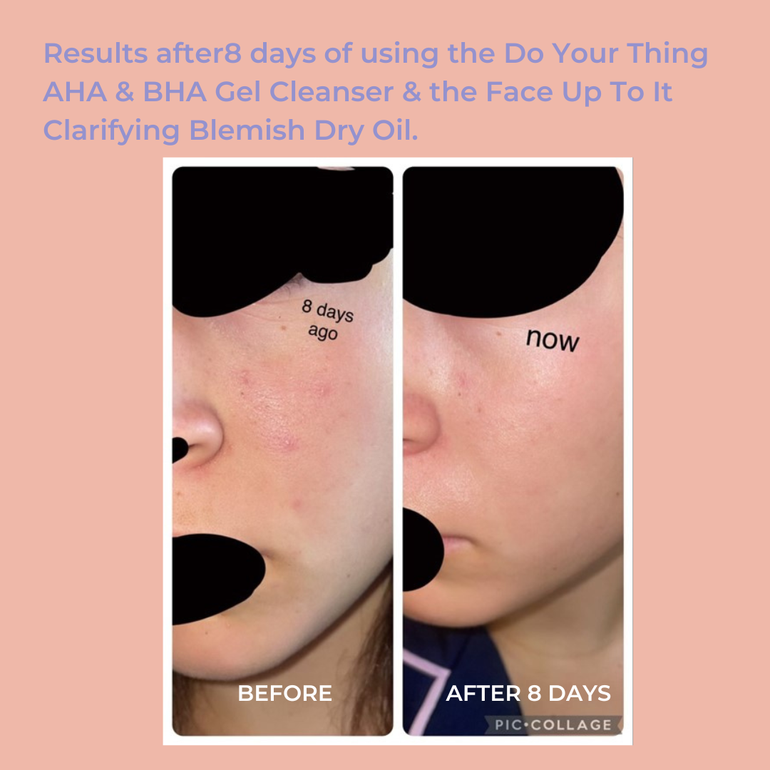 Do Your Thing AHA & BHA Gel Cleanser for Oil Control 3.4 fl oz